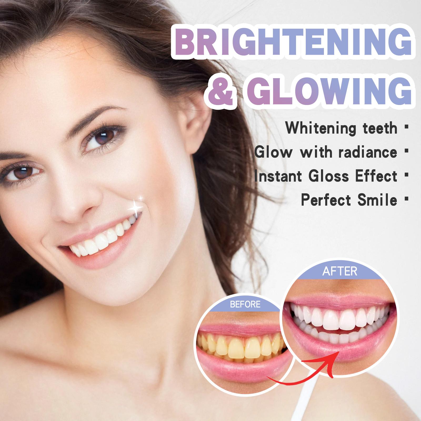 Night Teeth Whitening Pen – Effortless Bright Smile